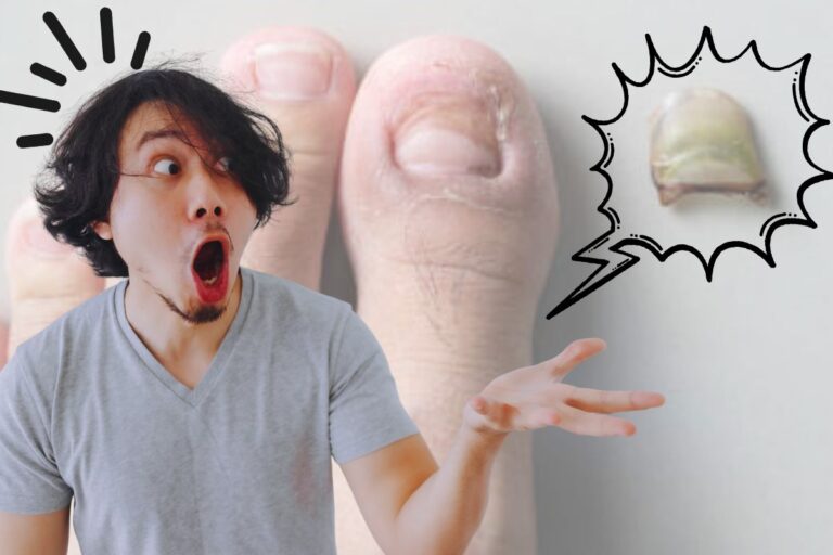 Why Did My Toenail Fall Off Without Pain 2026 Guide