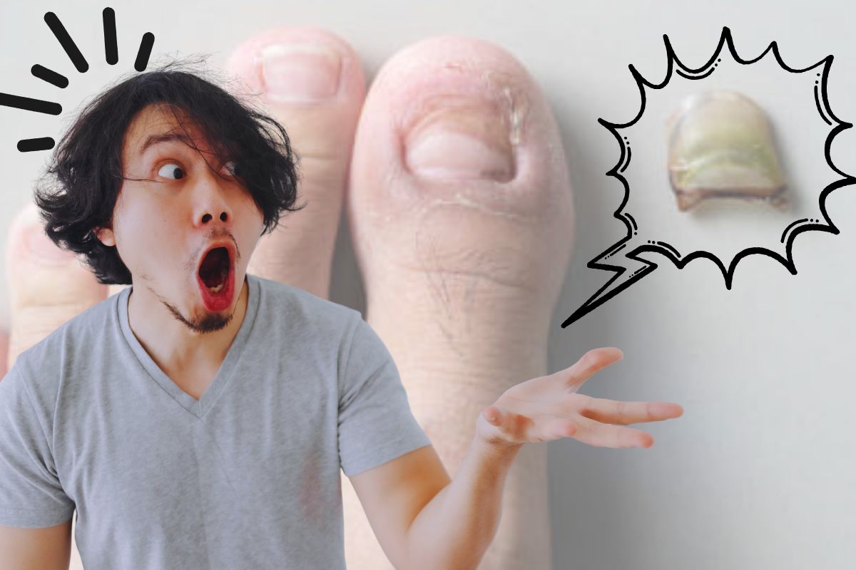 Why Did My Toenail Fall Off Without Pain 2026 Guide