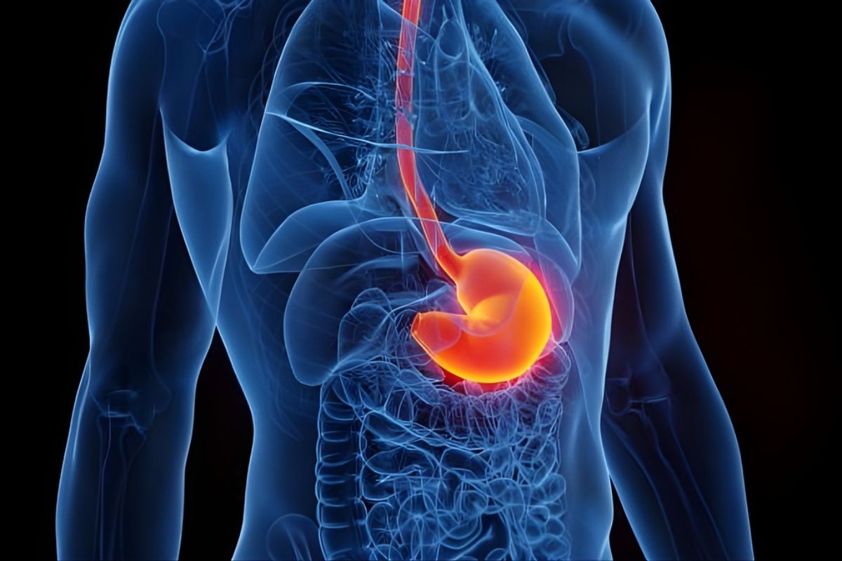 Can You Die From Acid Reflux in Your Sleep Facts