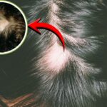 How to Dissolve a Cyst on the Head Naturally